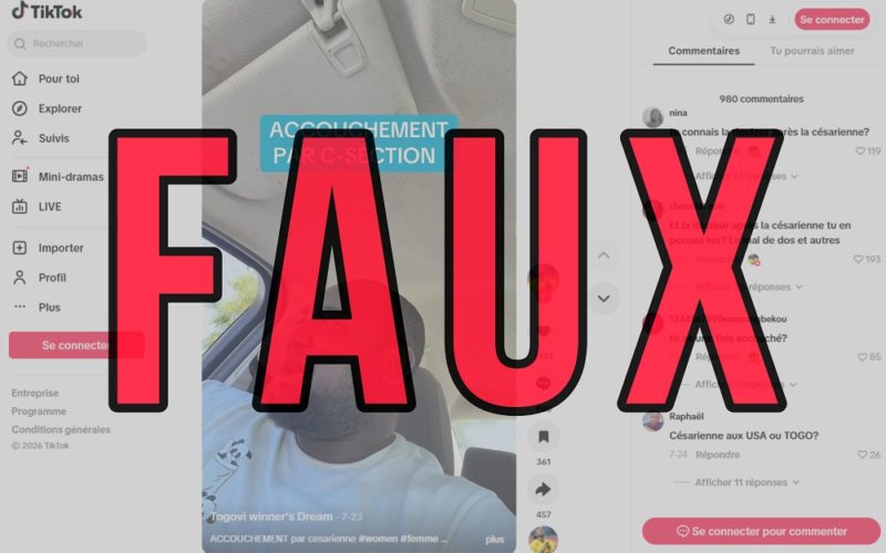 Non, la césarienne n’est pas meilleure que l’accouchement par voie basse dans tous les cas